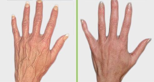 Comparison before and after treatment