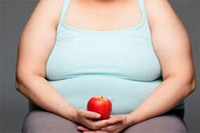 To cure varicose veins, you need to lose excess weight