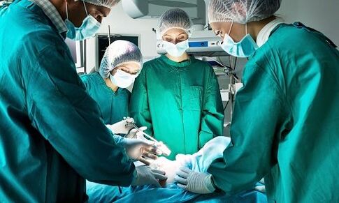 surgery for varicose veins in the legs