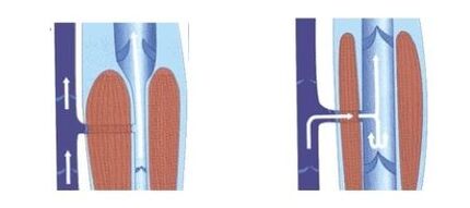 good functioning of the venous pump