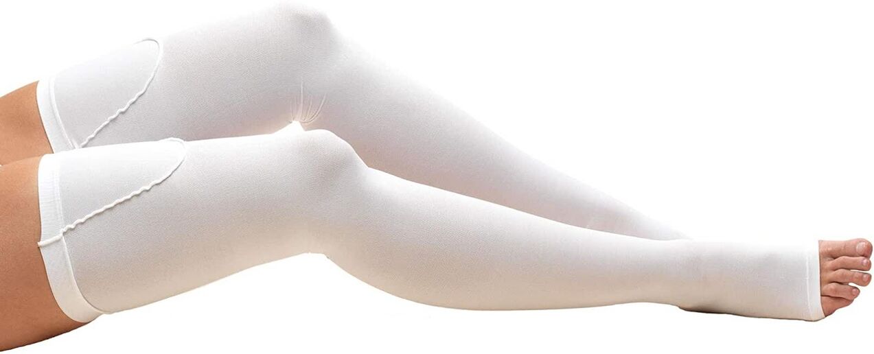 To treat varicose veins, you need to wear compression stockings. 